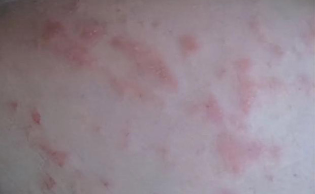 How to cure skin diseases
